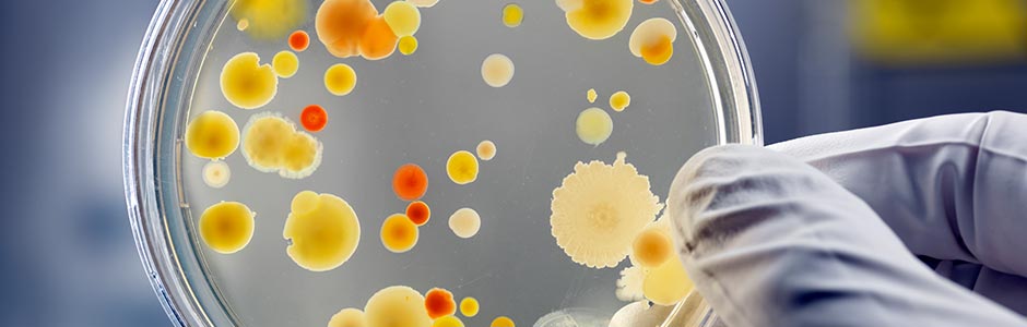Anti-infectives 